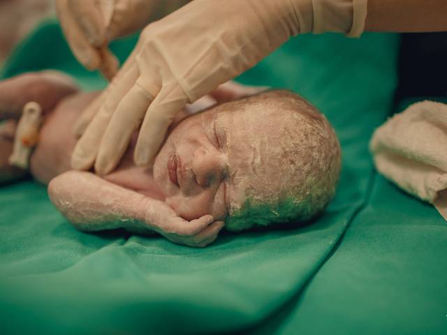 Partos de Clarisse e Laura