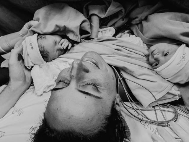 GRÁVIDAS E PARTO de Cesárea Intraparto de Gêmeas em São José dos Campos - São Paulo | Nascimento de Luísa e Lorena | Fotografia de Parto na Santa Casa de SJC | Prosa e Fotografia