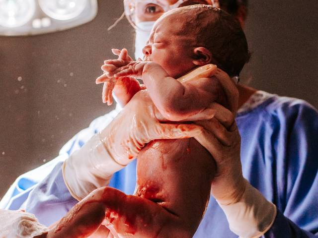 Parto de Parto - Estela