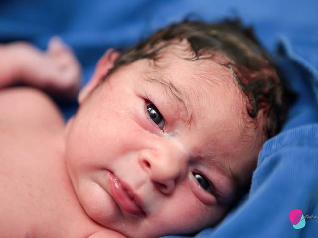 Partos de Nascimento Yara - PN