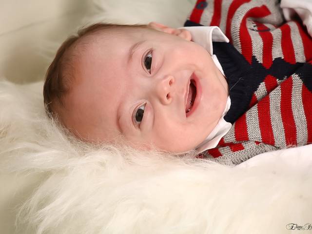 Acompanhamento de Enzo 2 meses