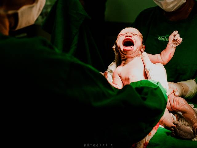 Parto de Nascimento de Malu