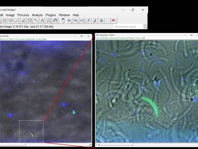 Microscopy by me of GFP Parasite
