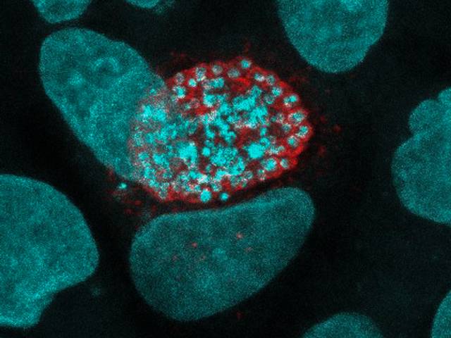 Microscopy by me of malaria liver stage