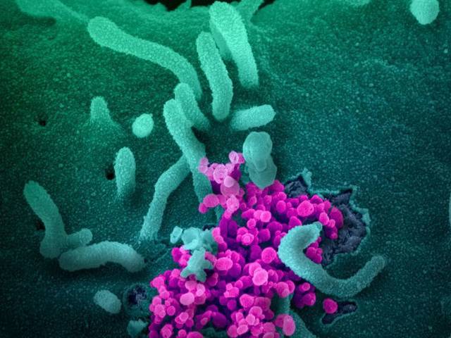 Microscopy © Not Me of Coronavirus captured