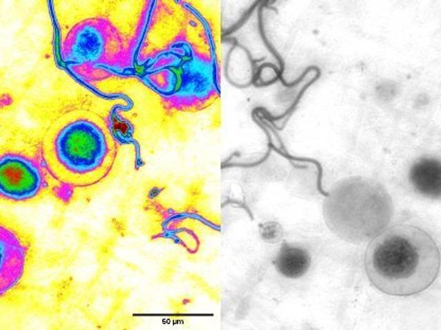 Microscopy by me of Developing 