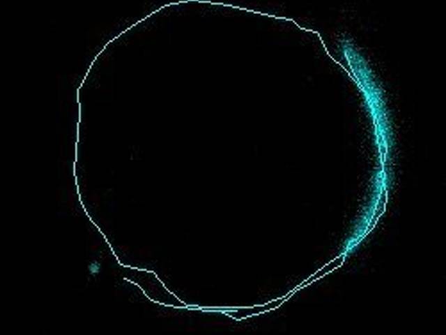 Microscopy by me of Parasite tracking