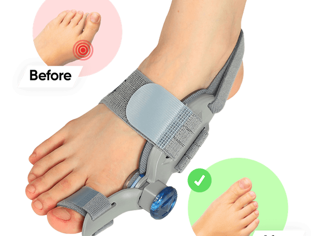 Technology of BuniCure Reviews: Price, Benefits & Official Buying Guide!