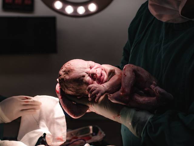 Ensaio Infantil Smash The Cake de Fotografias de um nascimento sustentado por cuidado e confiança