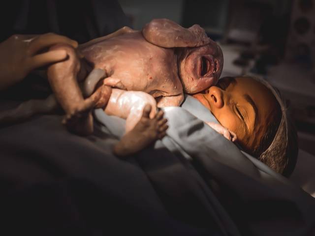 Parto de Fotografia de Parto - O Nascimento do João