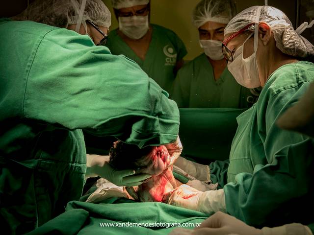 Gestante de Nascimento- João Miguel 