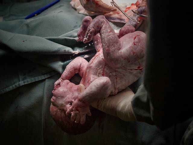 Nascimentos de Nascimento do João Guilherme