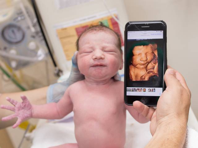 Partos  de Parto Normal - Gabriel 