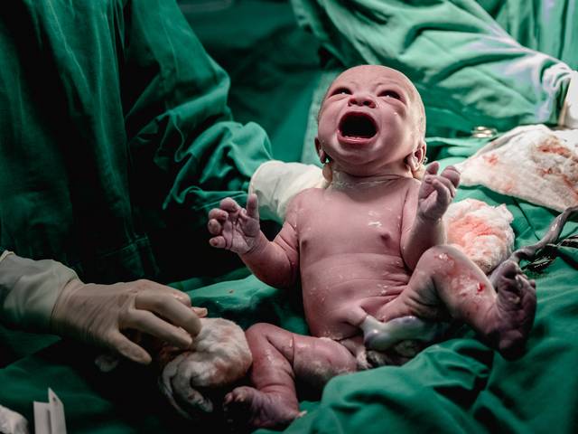 Parto de Cobertura Documental de Parto: A chegada da Luna