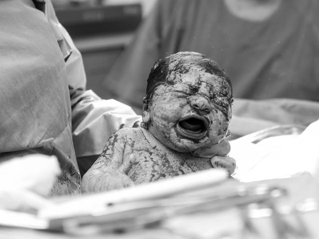 Parto  de Parto Luciana - nascimento Joao Marcelo