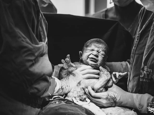 Parto de Parto - Cesárea Gabi | Bem-vindo ao mundo Lucas