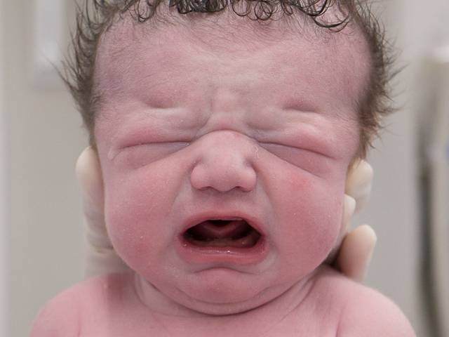 Cobertura de parto de Parto - Lucca (Pró Matre)