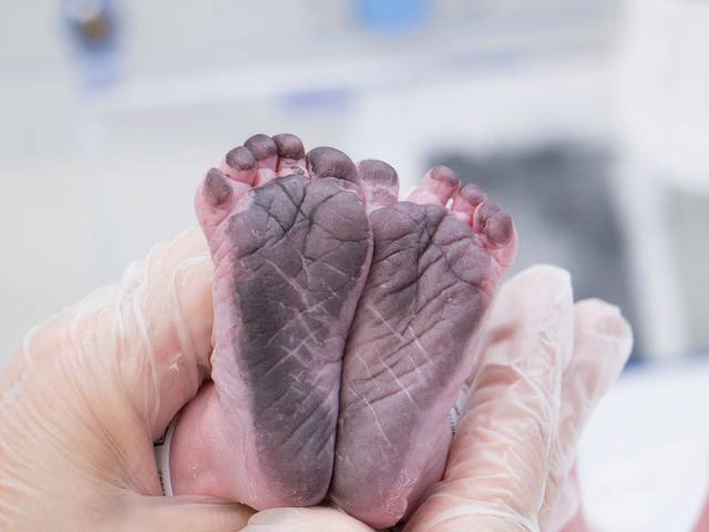 Cobertura de parto de Parto da Gabi