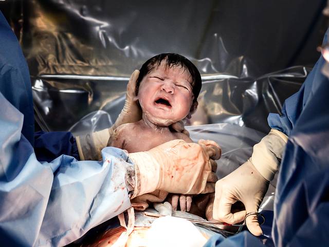 Parto de Adriana Aparecida