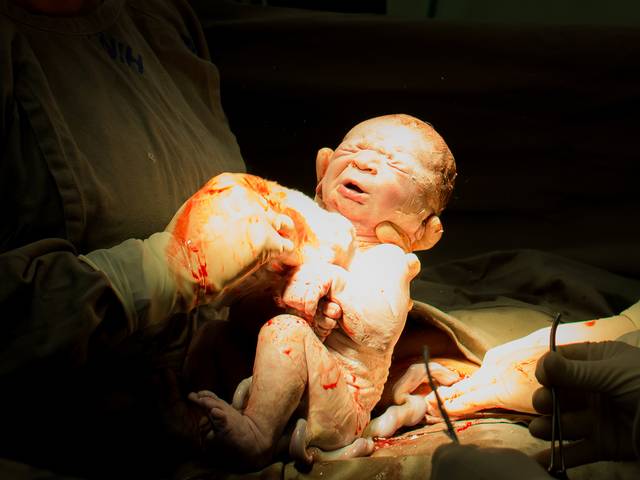 Parto de Thaísa Pereira 