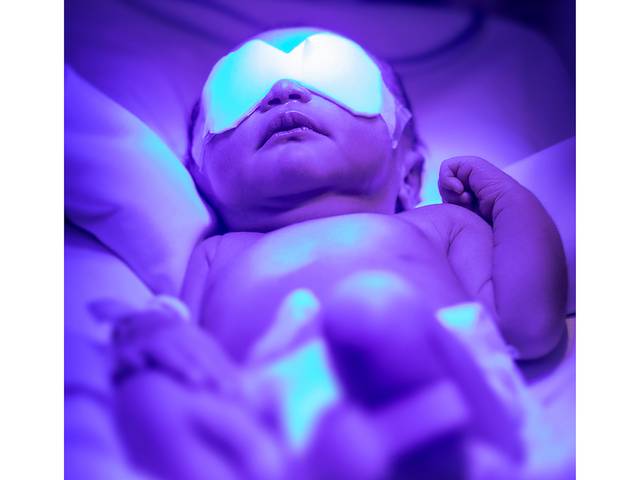 Exposição Fotográfica de Novembro Roxo - Mês da prematuridade