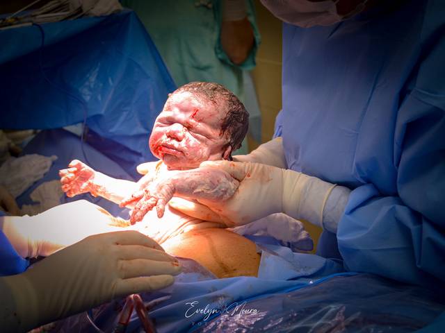 Partos de Parto Laila