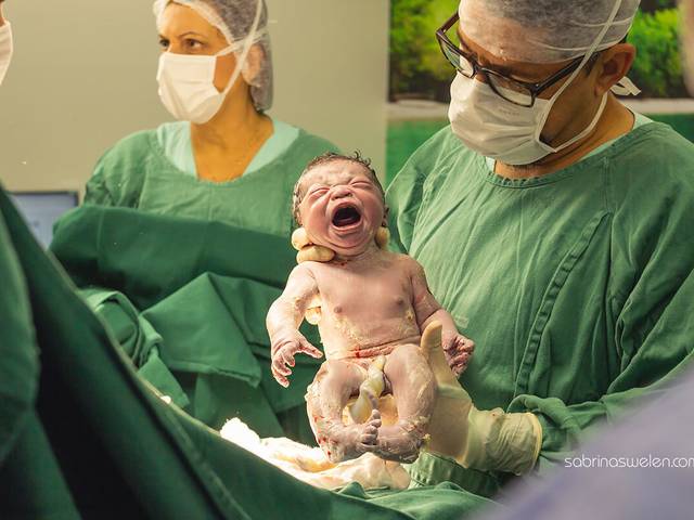 Parto de Parto Bernado