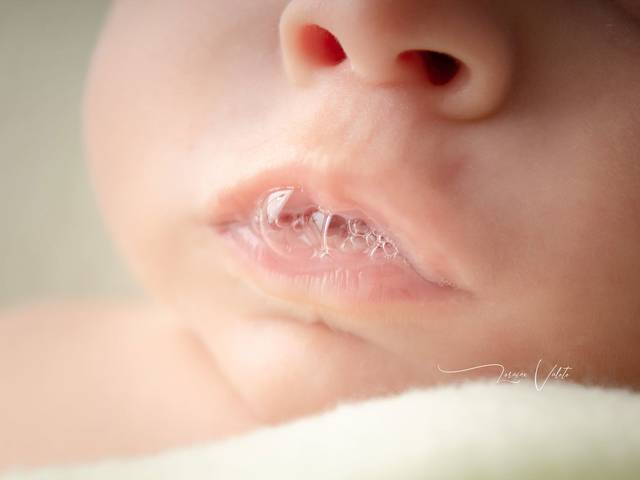 Infantil de Acompanhamento do bebê - 2 Meses