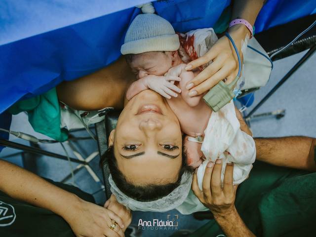 Birth of O Nascimento da Alice - Parto Cesária