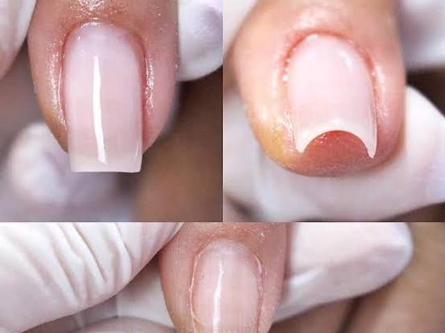 manicure de Banho de gel