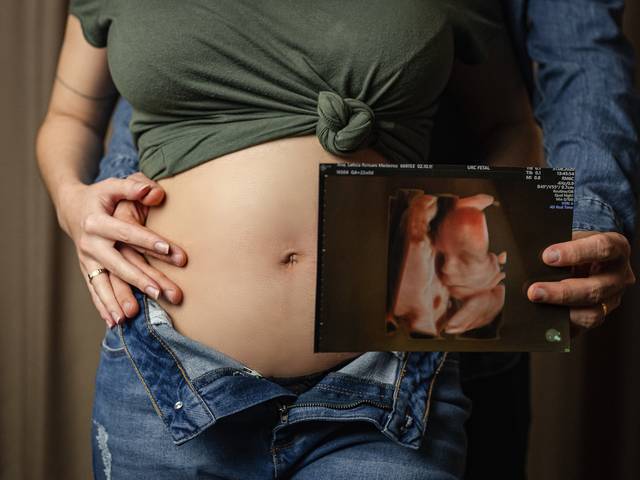 Revelação de Gravidez de Ana Letícia & Bruno esperam Miguel