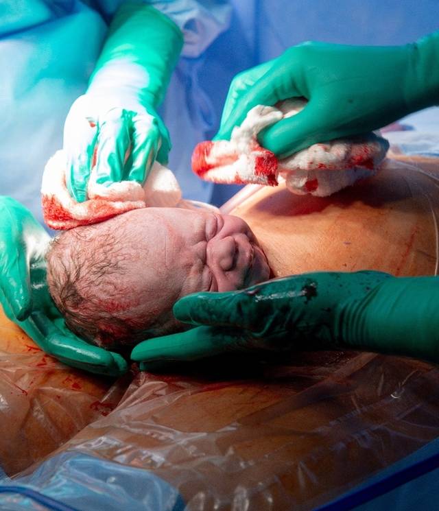 Parto de Parto da Liz