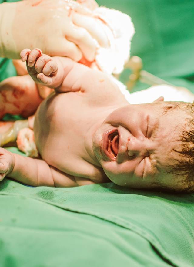 Parto de Nascimento Elisa