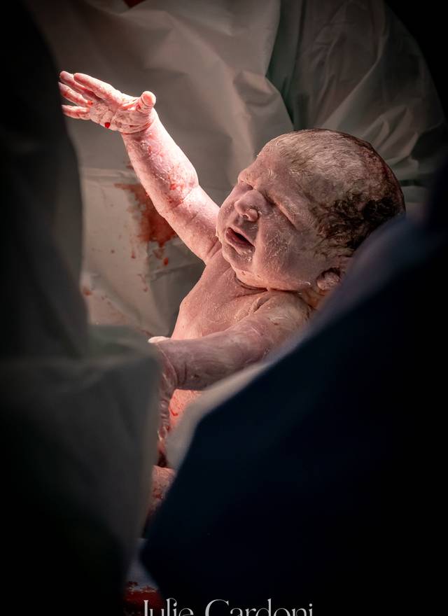 Fotografia de Nascimento de Nascimento da Lice