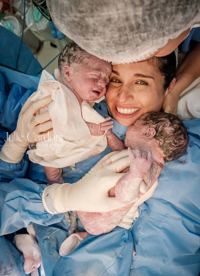Fotografia de Nascimento de Nascimento da Luísa e do Heitor | Parto Cesárea Gêmeos