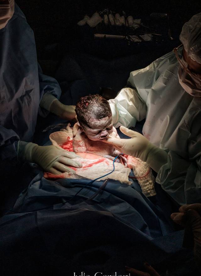 Fotografia de Nascimento de Nascimento Maria Cecilia | Parto Cesáreo