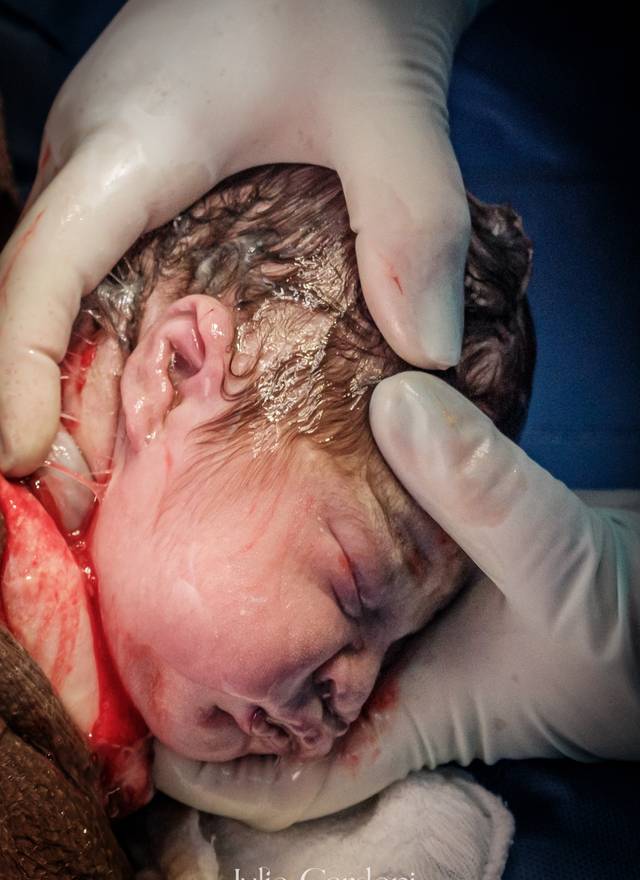 Fotografia de Nascimento de Nascimento Giovana  | Parto Normal