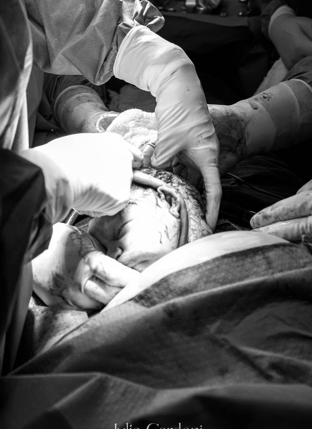 Fotografia de Nascimento de Nascimento Joaquim | Parto Cesárea
