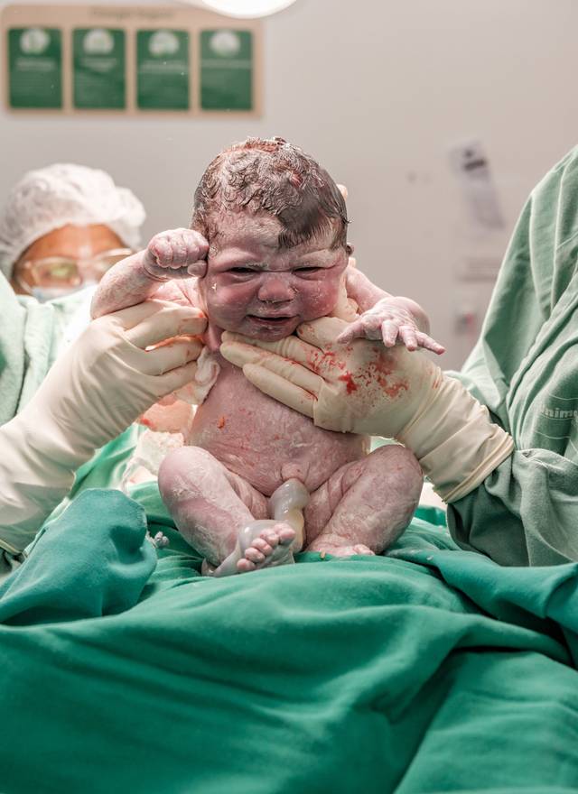 Fotografia de Nascimento de Nascimento Júlia | Parto Cesárea