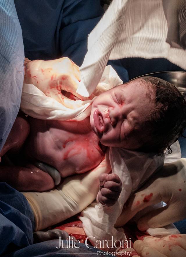 Fotografia de Nascimento de Nascimento Celina | Parto Cesárea