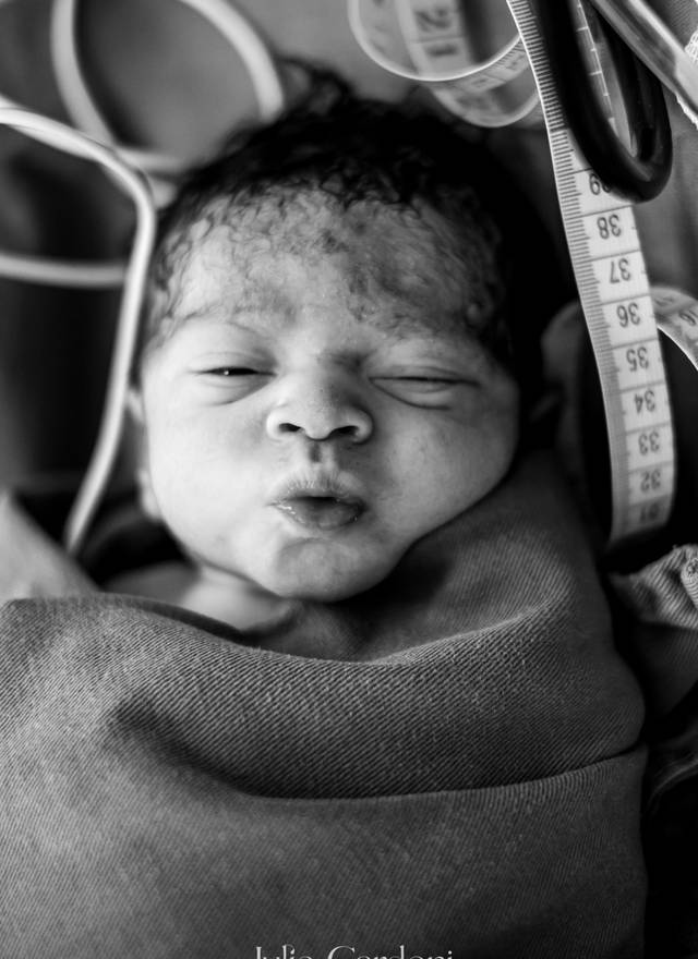 Fotografia de Nascimento de Nascimento Stefan Lucas | Parto Cesárea