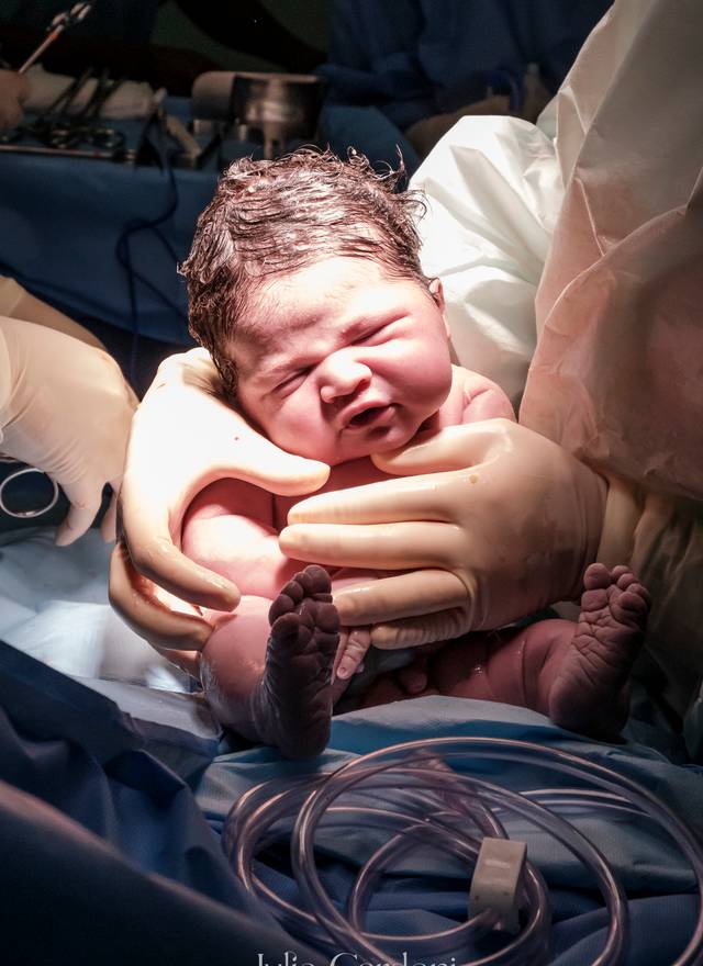 Fotografia de Nascimento de Nascimento Breno | Parto Cesárea 