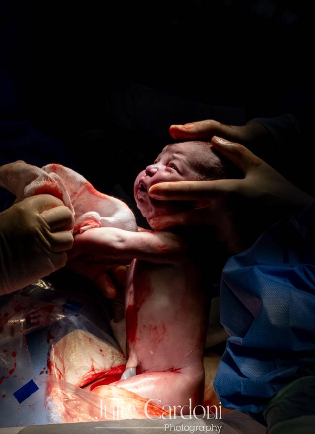 Fotografia de Nascimento de Nascimento Maria Júlia | Parto Cesárea