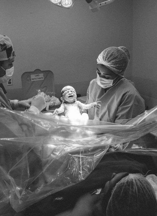 Parto Cesária de Bem-vindo, Bernardo