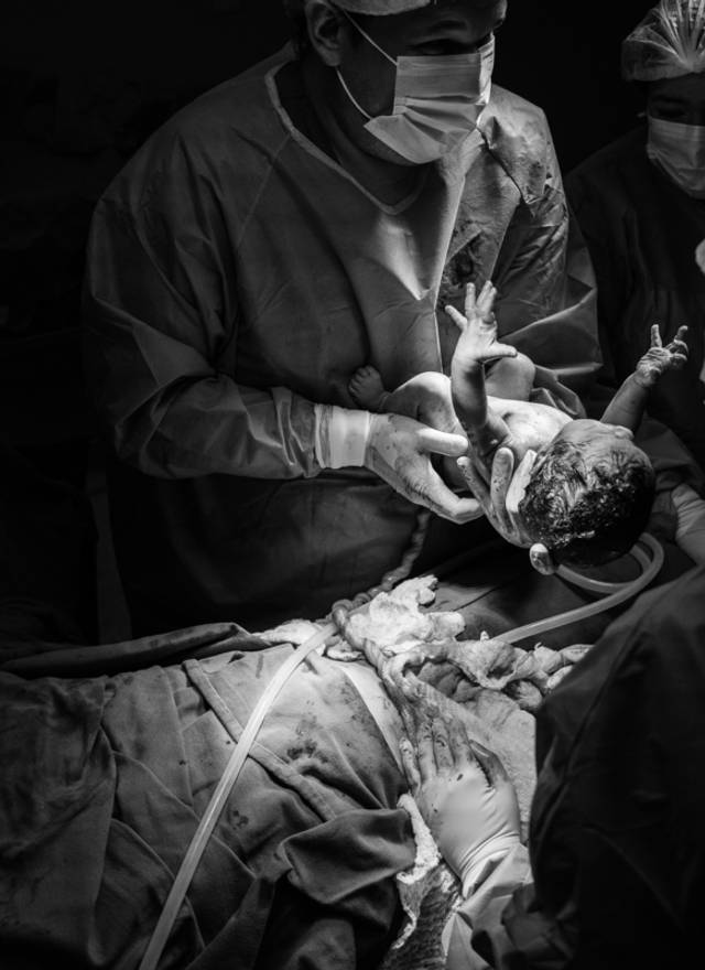 Parto de Parto - A Chegada de João Pedro - Andresa e Pablo