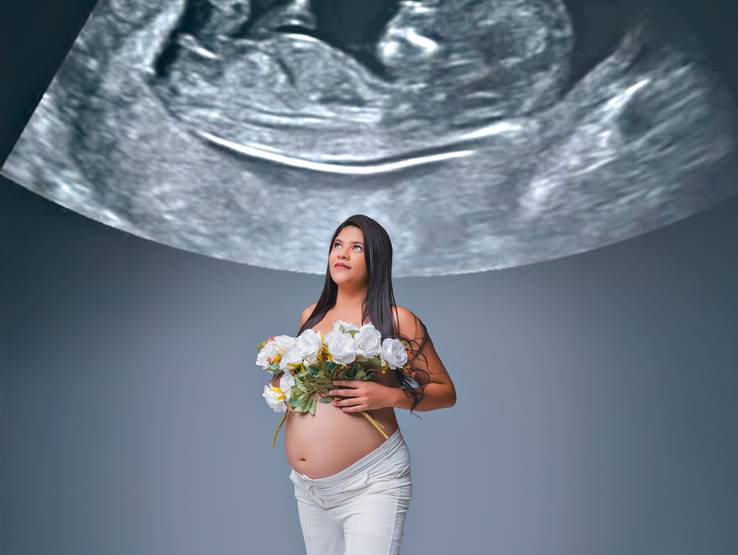 Gestantes de Gestante Hayalla