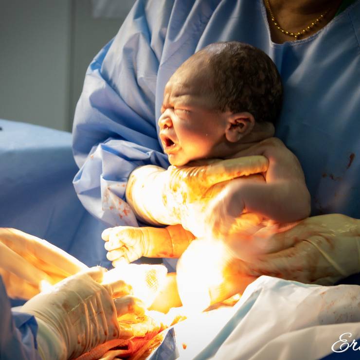 Parto de Nascimento de André Vicente