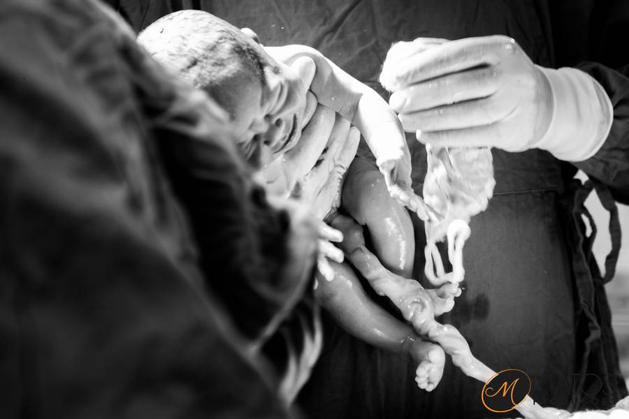 Partos de Fotografia de Nascimento