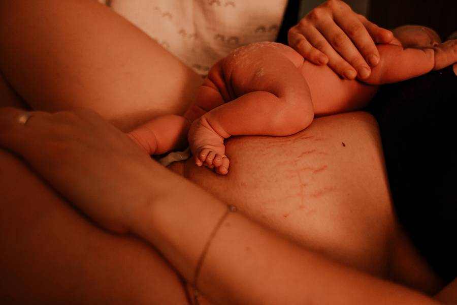 PARTO de Nascimento da Lara