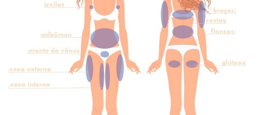 Regiões para Aplicação de Criolipólise.